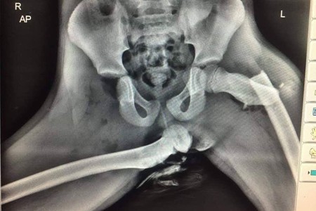 Esta es la imagen que demuestra por qué nunca se debe viajar en coche con los pies en el salpicadero