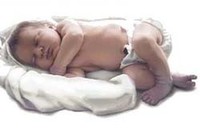 Estudian la relación de las manchas de nacimiento con el cáncer infantil