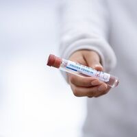 Casi el 6 por ciento los autónomos se dieron de baja por enfermedad debido a la covid-19 en 2020, según UPTA