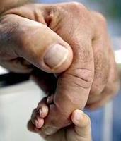 Protocolo de Groningen, ¿Eutanasia en los bebés holandeses que sufren espina bífida?