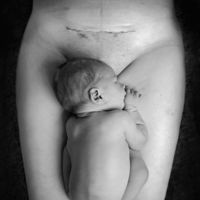 Ha vuelto a suceder: Facebook censura la foto de un bebé y la cicatriz de una cesárea