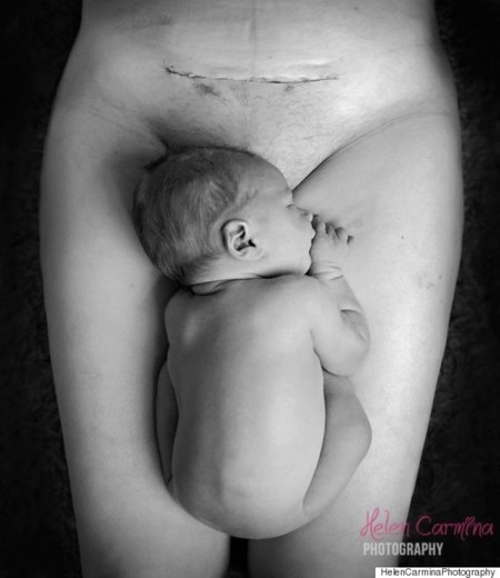Ha vuelto a suceder: Facebook censura la foto de un bebé y la cicatriz de una cesárea