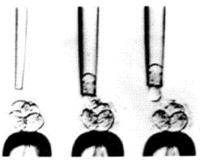 Padres que desean que sus hijos tengan las mismas deficiencias genéticas