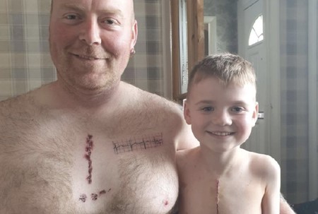 Un padre se tatúa la misma cicatriz de su hijo, operado del corazón, para demostrarle que no hay que avergonzarse