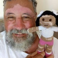 Vitilinda, la muñeca con manchas en la piel que un abuelo tejió para arrancar una sonrisa a su nieta con vitíligo