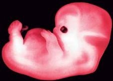 El primer bebé que evita la herencia genética del cáncer en el Reino Unido