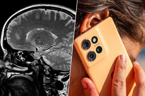 Estudio Cerebro Movil