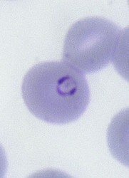 La malaria necesita sodio