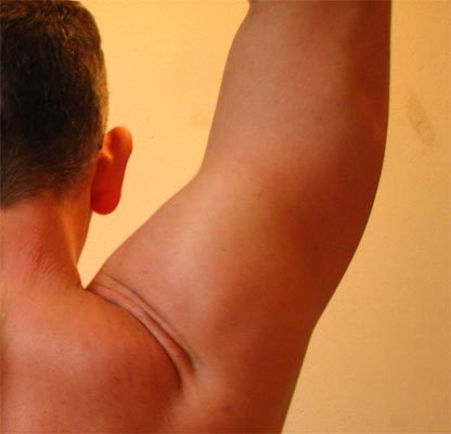 Evitar las lesiones del manguito rotador del hombro