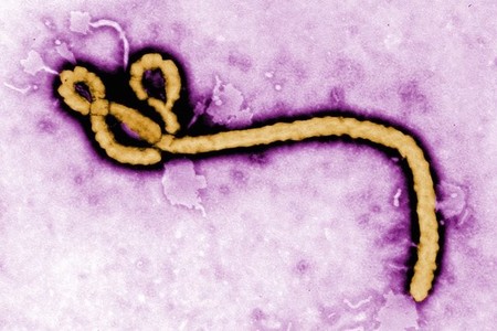 Uno de los estadounidenses infectados con Ébola se está recuperando gracias a un nuevo tratamiento experimental