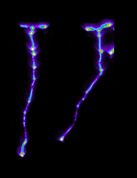 Autophagy Arabidopsis Plant Ezyme Study Credit Ucopenhagen 1m