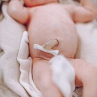 Cómo bañar al recién nacido antes de la caída del cordón umbilical 