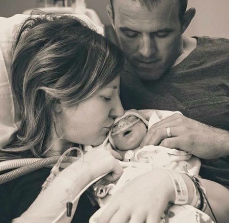 Deciden dar a luz a su hija con anencefalia, sabiendo que viviría pocas horas, para donar sus órganos