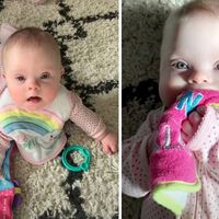 Conoce a estas preciosas gemelas idénticas con Síndrome de Down, algo que sucede en uno de cada dos millones de nacimientos 