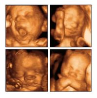 Ecografías 4D a domicilio