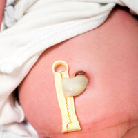 Cómo curar el ombligo del recién nacido