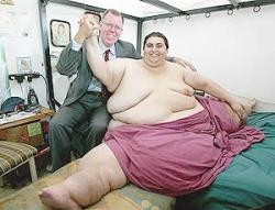 ¿Existe alguna relación entre obesidad y cáncer de colon?