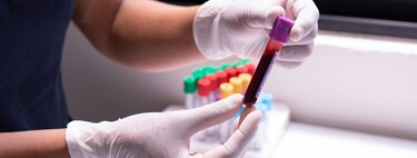 O fim do diagnóstico tardio: a nova invenção brasileira que identifica o câncer de mama logo no início apenas pelo sangue