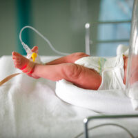 Nacer de forma prematura podría aumentar el riesgo de ser ingresado en un hospital durante la infancia