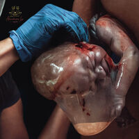 Las más poderosas e impactantes fotos del parto y el postparto ganadoras del año 2023 