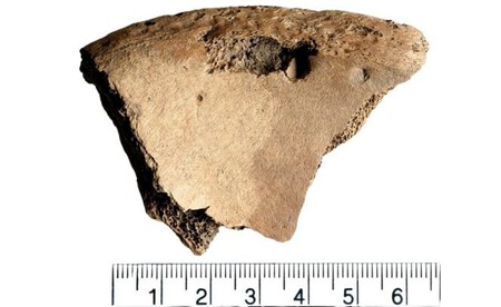 Pelvis bone