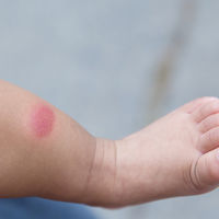 Mosquitos, avispas e insectos: repelentes, accesorios y gadgets para evitar picaduras