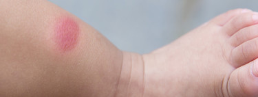 Mosquitos, avispas e insectos: repelentes, accesorios y gadgets para evitar picaduras