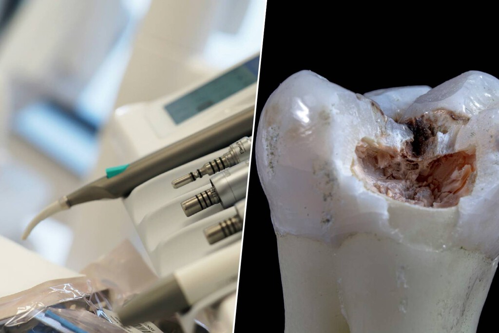 Regenerar el esmalte dental es el santo grial de la odontología. Y lo han logrado usando una parte de la oveja 