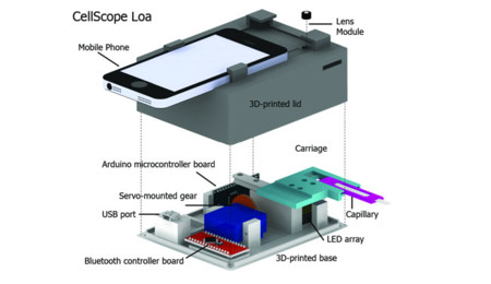 Tu teléfono se convierte en detector de parásitos con CellScope Loa