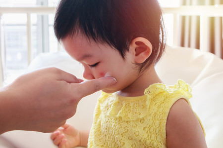 Absceso cutáneo en niños: causas, tratamiento y prevención de esta lesión de la piel