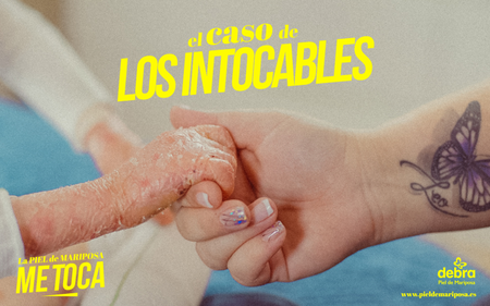 Frame Piel De Mariposa09 768x480