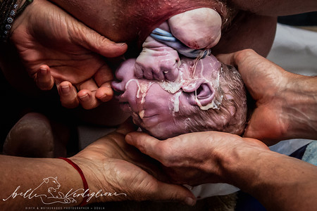 mejores-fotos-parto-2019