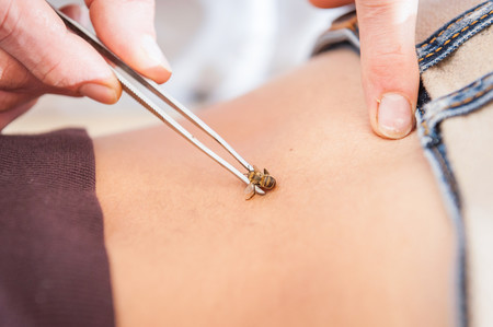 apiterapia-picadura-abeja