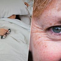 Dormir boca arriba para evitar "arrugas del sueño" suena muy bien. Sirve exactamente para lo contrario