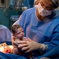 La foto viral de la bebé recién nacida con cara de 'enfadada' que se convirtió en un meme 