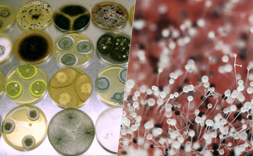 Una epidemia silenciosa está matando cada vez a más seres humanos en todo el planeta: las infecciones por hongos 