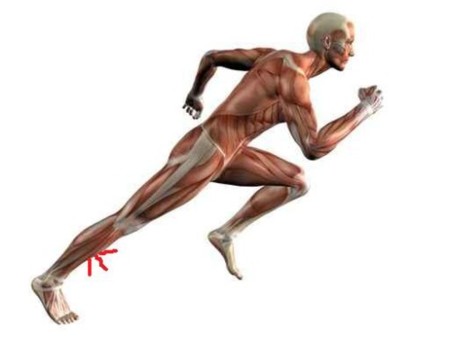 Periostitis tibial: qué es y cómo tratarla