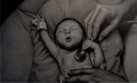 Paco Seoane Bebe Fonendo