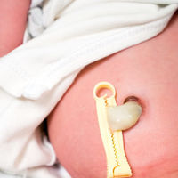 Cordón umbilical: cuáles son los signos de alarma que debemos vigilar