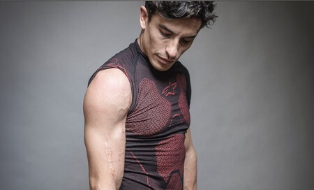 Marquez Cicatriz Brazo