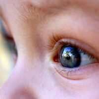 Cómo poner gotas en los ojos de los niños, sin llantos ni agobios 
