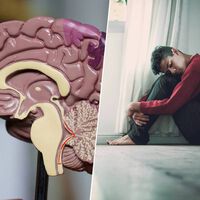 Un 30% de las depresiones no responden ni a pastillas ni a psicoterapia. La idea de un psiquiatra: tratarlas con ultrasonidos