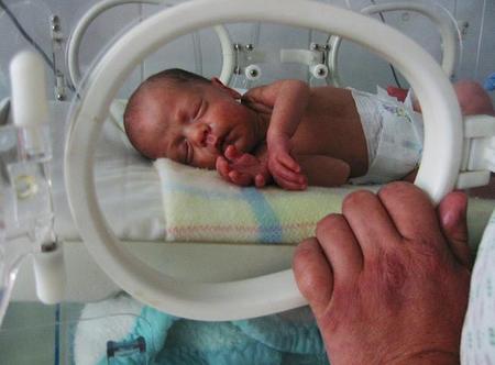 Babylux, proyecto para reducir el riesgo de daño cerebral en prematuros