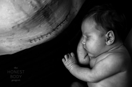 Fotos Cesarea Honest Body 4