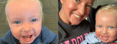 Una madre y su bebé son expulsados de un avión por padecer una enfermedad rara en la piel, que no es contagiosa