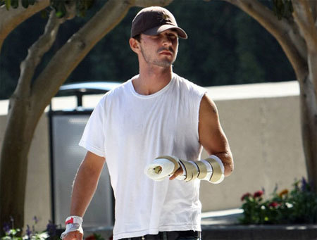 Shia LaBeouf podría perder un dedo