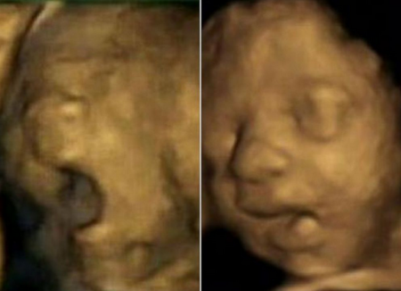 eco-4d-estudio-lateralidad