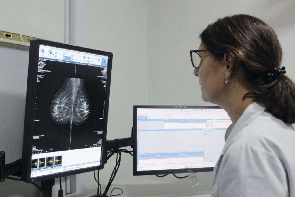 Red flag: Argentina entre los países con más casos de cáncer de mama y cuello de útero de América Latina. Factores de riesgo y qué opciones hay para prevenir y tratar 