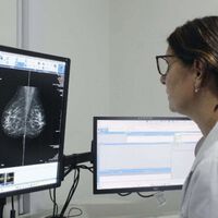 Red flag: Argentina entre los países con más casos de cáncer de mama y cuello de útero de América Latina. Factores de riesgo y qué opciones hay para prevenir y tratar 