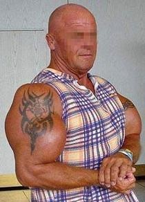 Synthol para aumentar los músculos, una práctica peligrosa